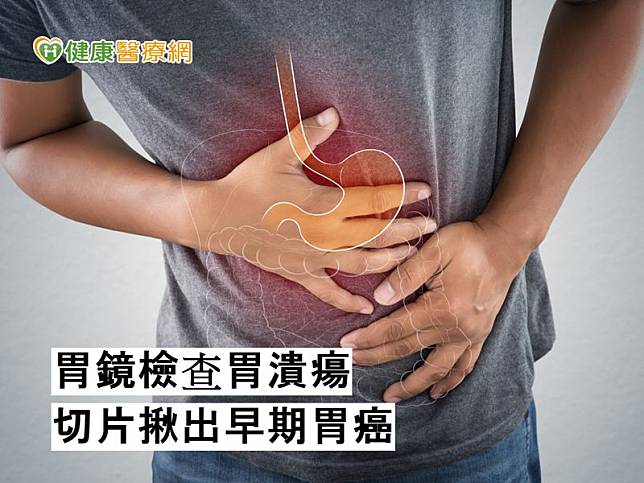 澄清醫院中港院區胃腸肝膽科主治醫師陳季宏表示，提醒民眾務必要定期癌檢，及早發現及早治療。