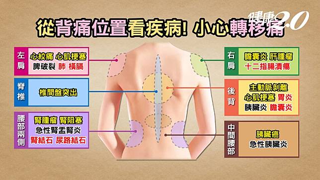 ▲背痛位置恐隱藏內臟疾病。