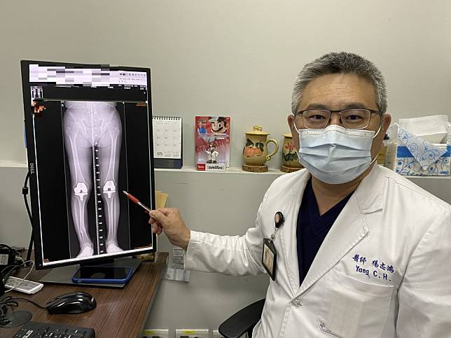 醫師楊志鴻透過微創手術，讓病患揮別40多年的膝關節變形。（記者黃俊昇翻攝）
