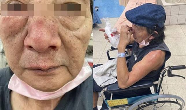 65歲阿伯和年輕人起口角進而爆發肢體衝突，導致頭部、膝蓋受傷。（翻攝畫面）