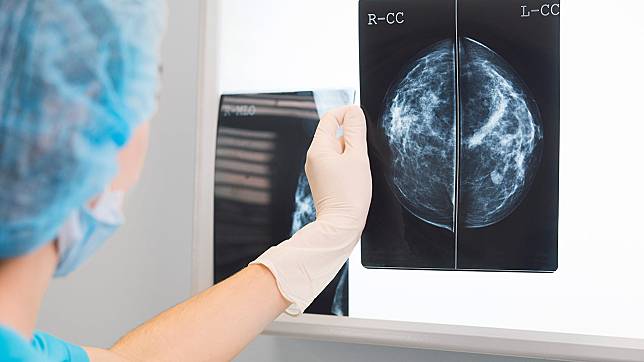 “มะเร็งเต้านม”  ภัยหญิง..แนวโน้มเพิ่มขึ้นอย่างต่อเนื่อง