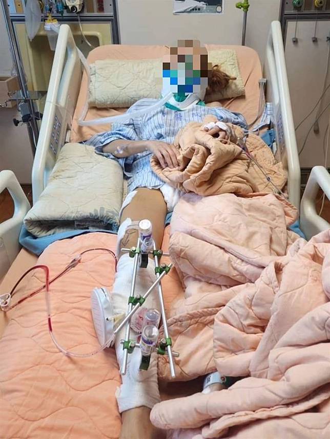 修長美腿因車禍被縫了好幾針，讓茱麗葉相當難過。（圖／翻攝畫面）