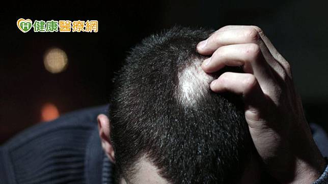 落髮不受季節影響，一年四季都會發生，但換季的確可能會影響頭皮狀況，使頭皮出油增加，導致脂漏性皮膚炎加劇、頭皮屑變多，有時也會伴隨落髮，但這種形式的落髮多屬於休止期落髮，毛囊並未受損，日後還是會重新長出來。