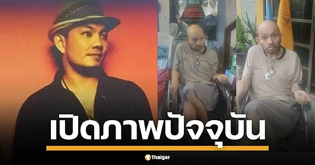 ใจหาย อดีตนักร้องดัง “สมิทธิ์ สมิธแอนด์เชน” ปัจจุบันป่วยหนัก อัมพฤกษ์ ซึ้งแฟนคลับไม่ทิ้ง