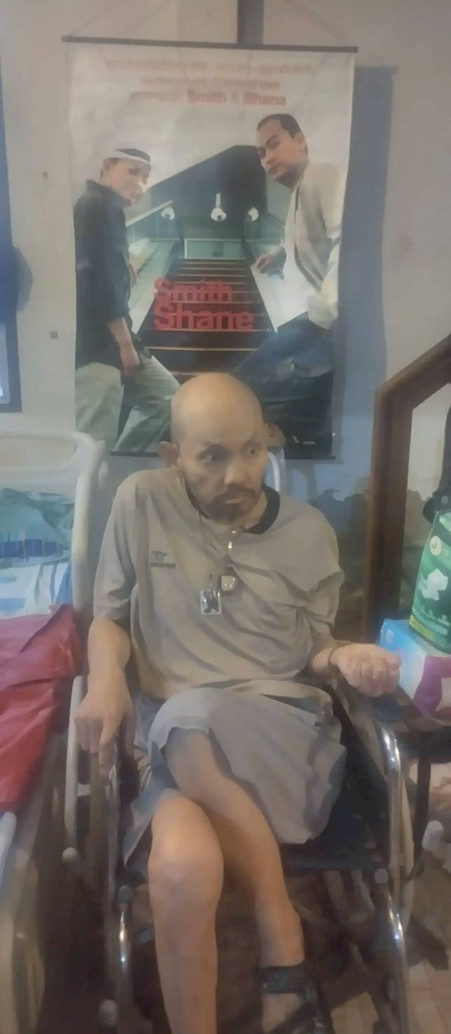 ทรุดหนักปวดเข่า ใช้ชีวิตลำบาก สมิทธิ์