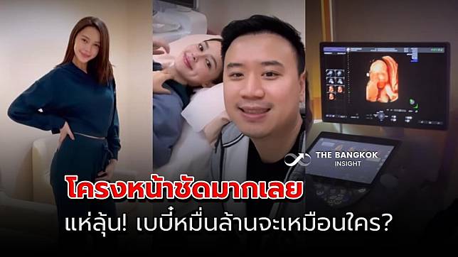 แพทริเซีย อวดโมเมนต์เห็นหน้าลูกครั้งแรก แห่ลุ้น! เบบี๋หมื่นล้านจะเหมือนใคร?