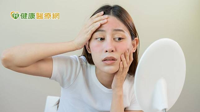 酒糟肌（Rosacea）又稱為玫瑰斑、酒糟性皮膚炎，是一種慢性的皮膚發炎狀態