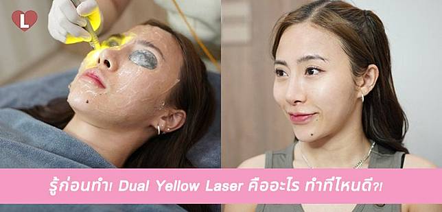 รู้ก่อนทำ! Dual Yellow Laser คืออะไร ทำที่ไหนดี?!