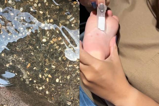 3歲童被一支工程施工遺留的釘槍釘針，狠狠刺進腳底，讓他痛到當場大哭。圖／翻攝自Threads @vmei10