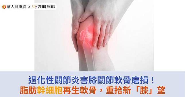 退化性關節炎害膝關節軟骨磨損！脂肪幹細胞再生軟骨，重拾新「膝」望