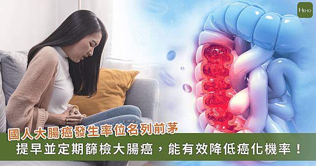 大腸癌入侵年輕族？專家拜託一定要做「這件事」防癌保命