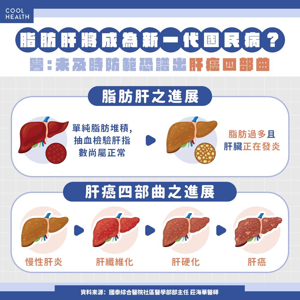 體重、BMI都正常，健檢卻驗出「脂肪肝」？ 醫：「泡芙人｣快做1件事改善紅字| 潮健康| LINE TODAY