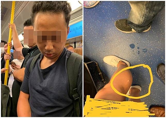 網上流傳有男子疑在西鐵車廂內自瀆，女乘客小腿及地上遺下懷疑精液。(互聯網)