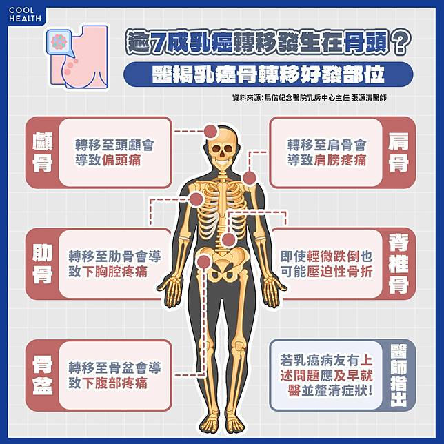 逾7成乳癌轉移發生在「骨頭」？ 女性荷爾蒙下降是一大警訊