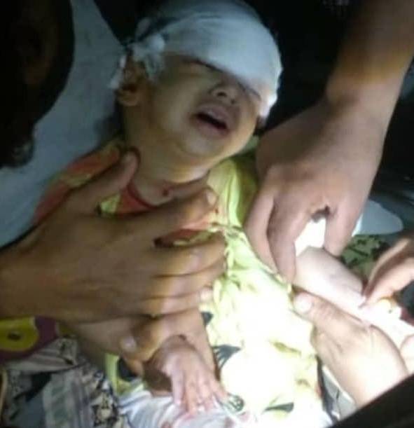 葉門內戰中被炸瞎雙眼的孩童   圖:擷取自twitter