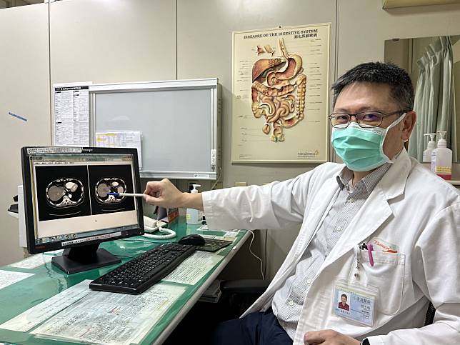 68歲男腹部脹痛發現肝癌　微波消融術精準熱死腫瘤
