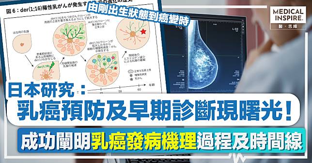 乳腺癌丨日本研究：乳癌預防及早期診斷現曙光！成功闡明乳癌發病機理過程及時間線。