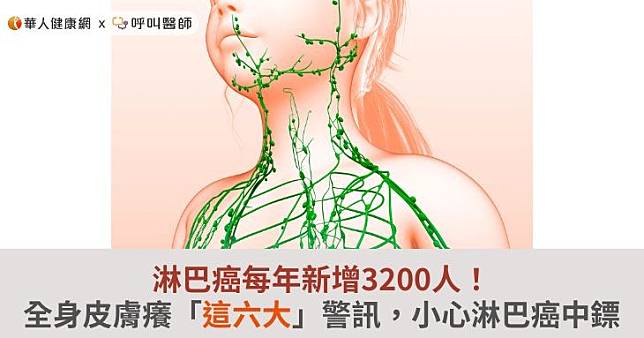 淋巴癌每年新增3200人！全身皮膚癢「這六大」警訊，小心淋巴癌中鏢