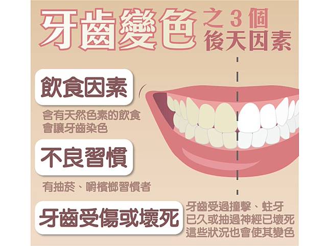 「大多數人的牙齒變色，是後天人為所造成。」造成牙齒變色的有3個後天因素。