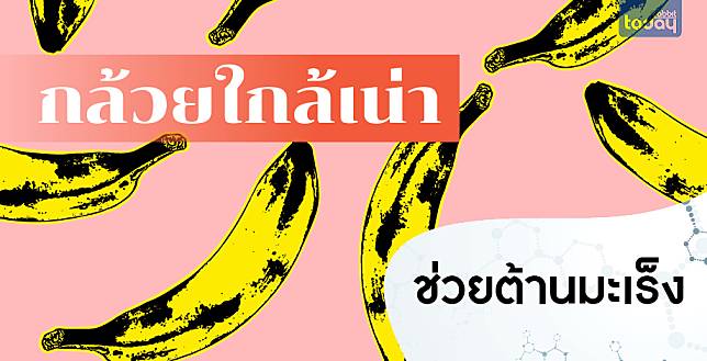 นักวิจัยชาวญี่ปุ่นแนะนำให้กินกล้วยที่สุกจนเปลือกคล้ำ เพราะช่วยต้านมะเร็งได้