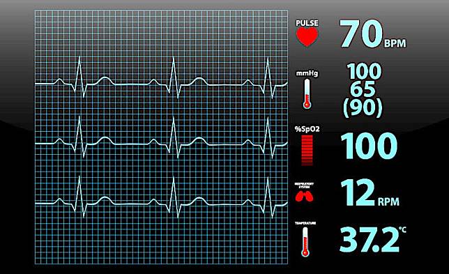 預防中風～新型心臟監測器可測徵兆