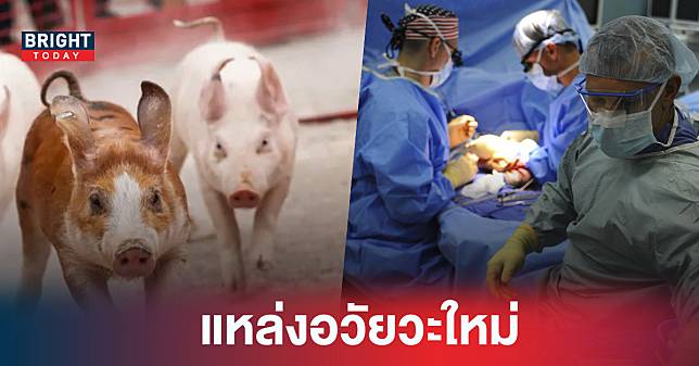 ทีมแพทย์ ปลูกถ่ายหัวใจหมู สู่ มนุษย์ พบเผยร่างกายตอบสนองดี เป็นหนทางการสร้างอวัยวะใหม่