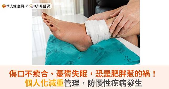 傷口不癒合、憂鬱失眠，恐是肥胖惹的禍！個人化減重管理，防慢性疾病發生