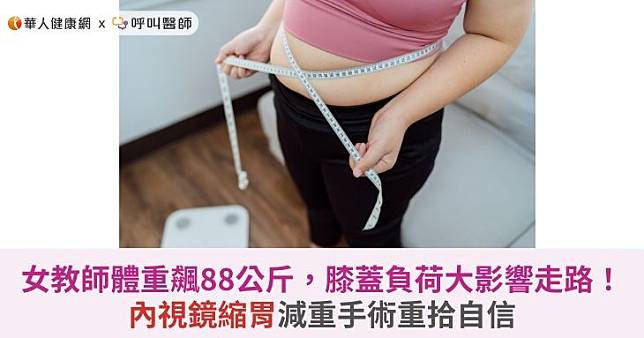 女教師體重飆88公斤，膝蓋負荷大影響走路！內視鏡縮胃減重手術重拾自信