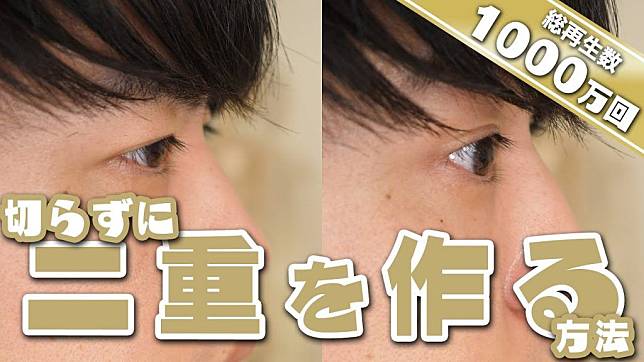 雙眼皮按摩法,單眼皮,水腫泡眼,日本