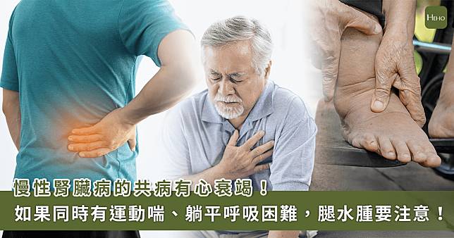 68 歲翁慢性腎病！喘不過氣、腳踝腫　醫檢查：心衰竭