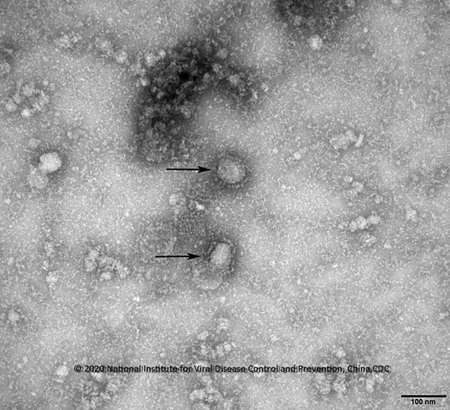 新型冠狀病毒(資料圖片)