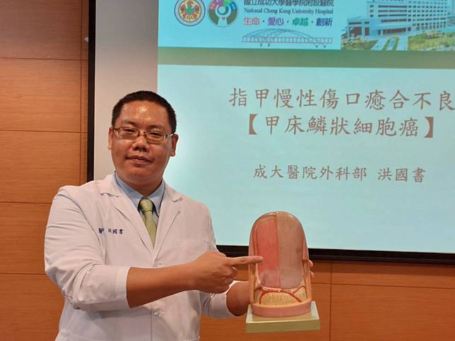 醫師洪國書說，甲床鱗狀細胞癌好發於50-70歲男性，最常發生部位是拇指及大腳趾。 （記者葉進耀攝）