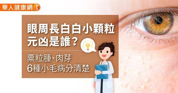 【影音版】眼周長白白小顆粒，元凶是誰？粟粒腫、肉芽6種小毛病分清楚