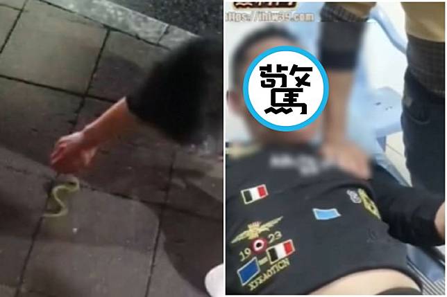 慎入！男逞強捉小青蛇下場慘了，全臉腫成「大頭佛」狀況不妙。（翻自《黑料網》）