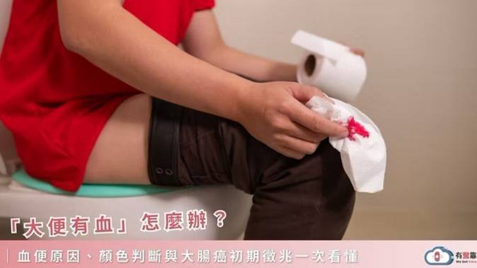 大便有血怎麼辦？血便顏色、原因與大腸癌初期徵兆解析 | 有醫靠 | LINE TODAY