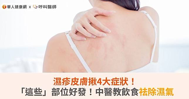 濕疹皮膚揪4大症狀！「這些」部位好發！中醫教飲食祛除濕氣