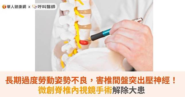 長期過度勞動姿勢不良，害椎間盤突出壓神經！微創脊椎內視鏡手術解除大患