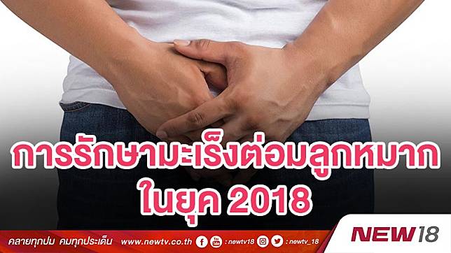 การรักษามะเร็งต่อมลูกหมากในยุค 2018 