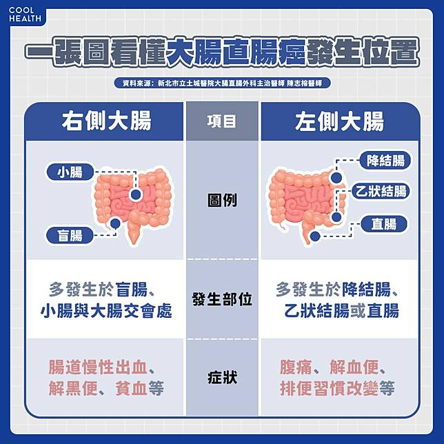 大腸癌發生位置不同症狀也不同？ 症狀容易與痔瘡、拉肚子混淆？