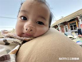 貼著鼻模的軒軒，趴在羅慧夫基金會公關黃柏儒哥哥身上，模樣相當可愛。（圖／記者張雅筑攝）