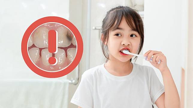 防蛀長期抗戰！兒童牙醫：預防孩子蛀牙有八大重點