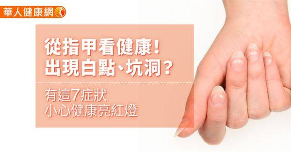 從指甲看健康！出現白點、坑洞？有這7症狀，小心健康亮紅燈