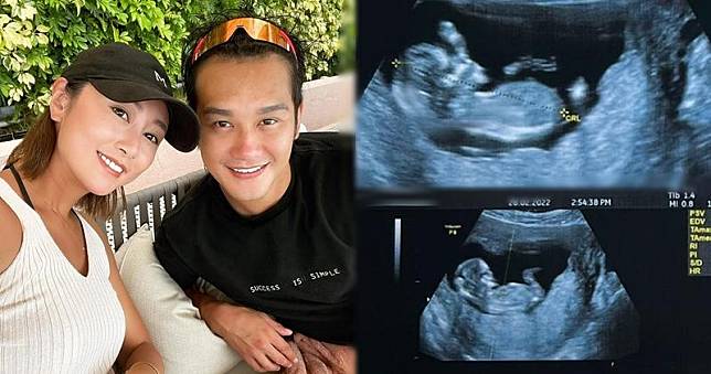 郭思琳分享與未婚夫吳浩康的合照，以及腹中胎兒的超聲波相，稱已收到大家的祝福。（郭思琳Instagram圖片 / 明報製圖）