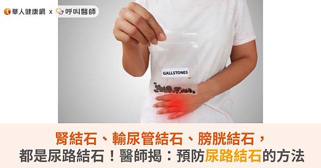 腎結石、輸尿管結石、膀胱結石，都是尿路結石！醫師揭：預防尿路結石方法