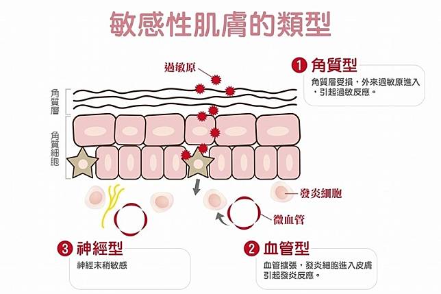 換季時，敏感性皮膚傷不起，一直過敏怎麼辦？皮膚科醫師教你這樣做