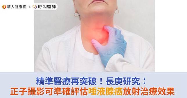 精準醫療再突破！長庚研究：正子攝影可準確評估唾液腺癌放射治療效果