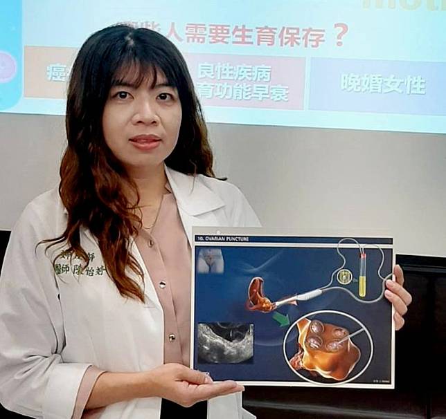 奇美醫婦產部主治醫師陳怡婷表示，該院已有多位病人在接受癌療前採取凍卵，並進行胚胎植入成功產子。（記者汪惠松攝）