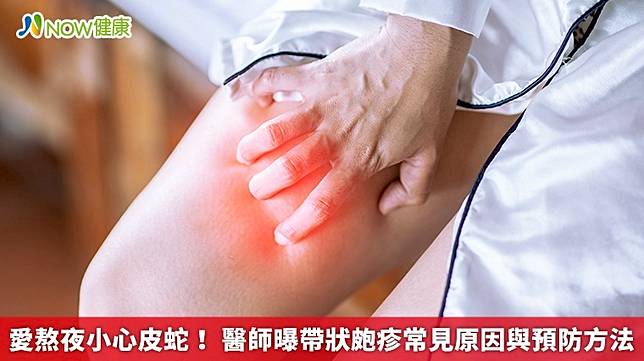▲帶狀皰疹俗稱「皮蛇」，常與壓力大、熬夜有關，若想要有效預防帶狀性疱疹找上你，醫師建議可以考慮做這件事。（圖／NOW健康製作；圖片來源／ingimage）