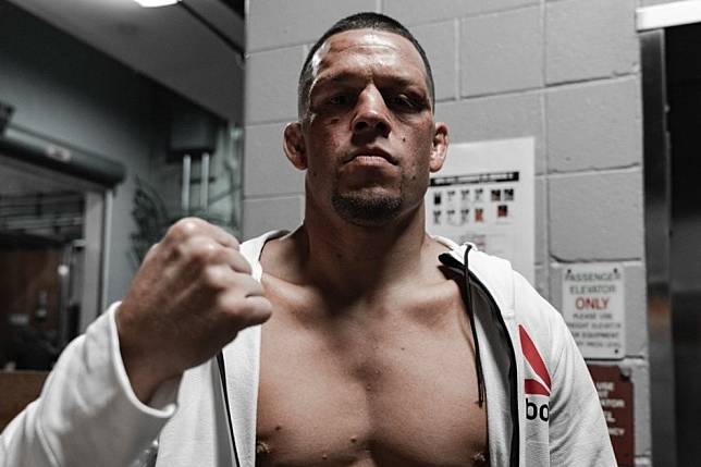 Nate Diaz poses after beating Anthony Pettis.