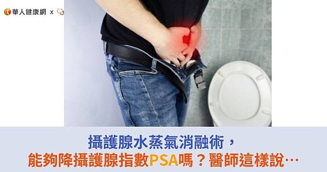 攝護腺水蒸氣消融術，能夠降攝護腺指數PSA嗎？醫師這樣說…